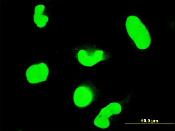 STAT6 Antibody - Immunofluorescence of monoclonal antibody to STAT6 on HeLa cell. [antibody concentration 10 ug/ml]