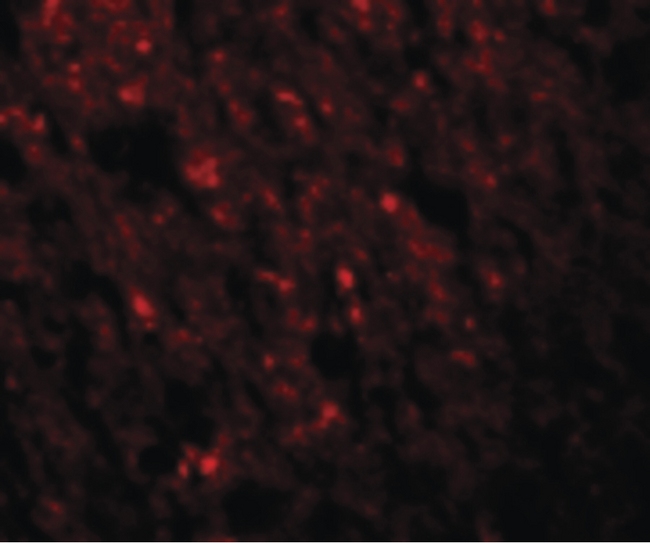 STAU1 / Staufen Antibody - Immunofluorescence of STAU1 in Human Brain cells with STAU1 antibody at 20 ug/ml.