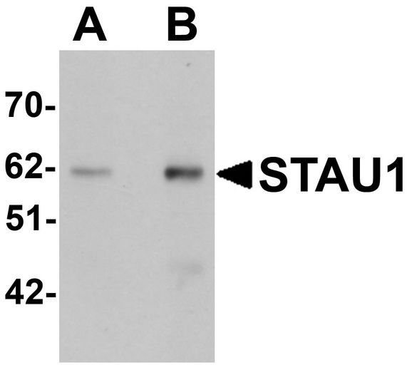 STAU1 / Staufen Antibody - Western blot analysis of STAU1 in rat brain tissue lysate with STAU1 antibody at (A) 1 and (B) 2 ug/ml.