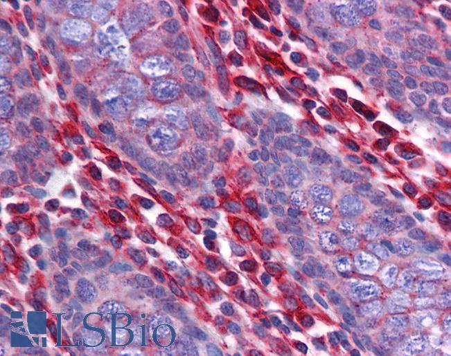 STAU1 / Staufen Antibody - Anti-STAU1 / Staufen antibody IHC of human colon. Immunohistochemistry of formalin-fixed, paraffin-embedded tissue after heat-induced antigen retrieval. Antibody concentration 5 ug/ml.