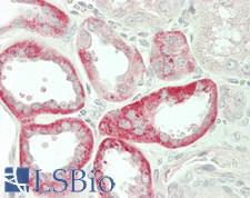 STC1 / Stanniocalcin Antibody - Human Kidney: Formalin-Fixed, Paraffin-Embedded (FFPE)