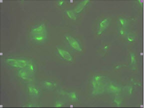 STEAP1 / STEAP Antibody - Immunofluorescence staining of human  LNCap cell colony with monoclonal antihuman STEAP1 antibody