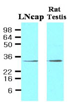 STEAP1 / STEAP Antibody
