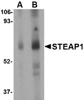 STEAP1 / STEAP Antibody - Western blot of human spleen tissue lysate with STEAP1 antibody at (A) 1 and (B) 2 ug/ml.