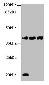 STEAP1 / STEAP Antibody - Western blot All lanes: STEAP1 antibody at 1µg/ml Lane 1: U87 whole cell lysate Lane 2: A431 whole cell lysate Lane 3: A549 whole cell lysate Secondary Goat polyclonal to rabbit IgG at 1/10000 dilution Predicted band size: 40 kDa Observed band size: 40, 18 kDa