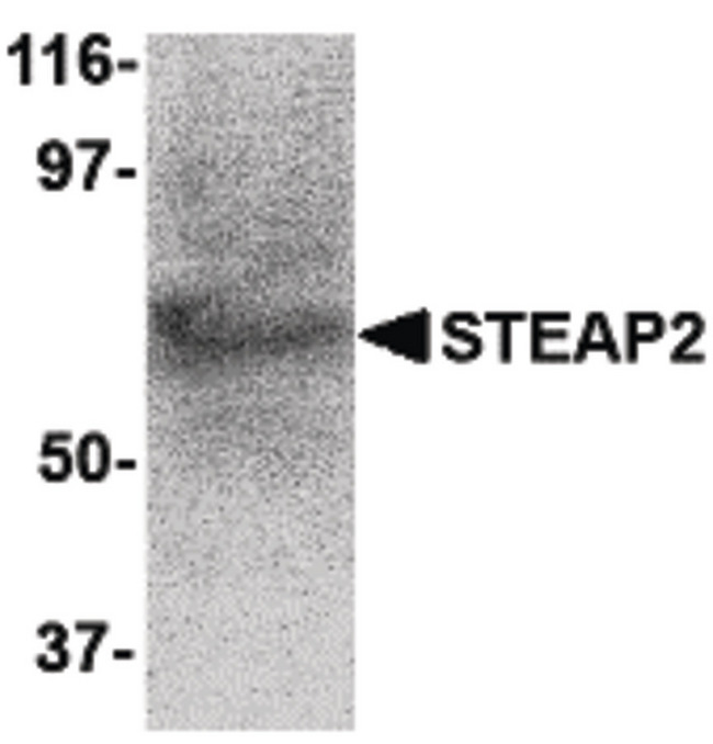 STEAP2 Antibody - Western blot of STEAP2 in human prostate tissue lysate with STEAP2 antibody at 1 ug/ml.