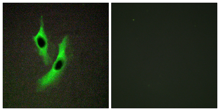 STEAP4 Antibody - Immunofluorescence analysis of HeLa cells, using STEAP4 Antibody. The picture on the right is blocked with the synthesized peptide.