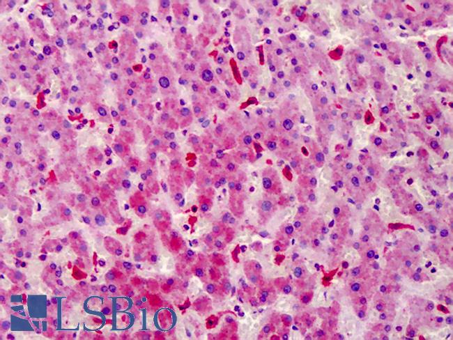 STEAP4 Antibody - Anti-STEAP4 antibody IHC of human liver. Immunohistochemistry of formalin-fixed, paraffin-embedded tissue after heat-induced antigen retrieval. Antibody dilution 1:100.