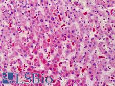 STEAP4 Antibody - Anti-STEAP4 antibody IHC of human liver. Immunohistochemistry of formalin-fixed, paraffin-embedded tissue after heat-induced antigen retrieval. Antibody dilution 1:100.