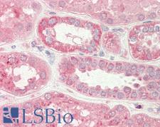 STIM2 Antibody - Human Kidney: Formalin-Fixed, Paraffin-Embedded (FFPE)