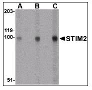 STIM2 Antibody - Western blot of STIM2 in A-20 cell lysate with STIM2 Antibody at (A) 0.5, (B) 1 and (C) 2 ug/ml.