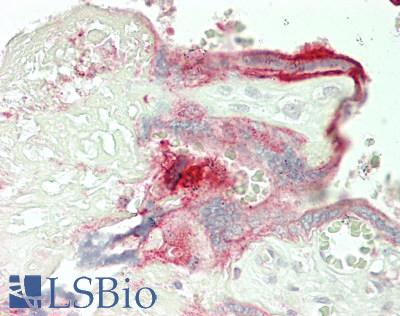 STK10 / LOK Antibody - Human Placenta: Formalin-Fixed, Paraffin-Embedded (FFPE)
