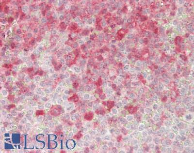 STK10 / LOK Antibody - Human Spleen: Formalin-Fixed, Paraffin-Embedded (FFPE)