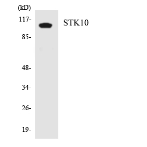STK10 / LOK Antibody - Western blot analysis of the lysates from HT-29 cells using STK10 antibody.