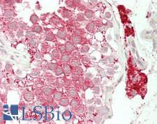 STK11 / LKB1 Antibody - Human Testis: Formalin-Fixed, Paraffin-Embedded (FFPE)