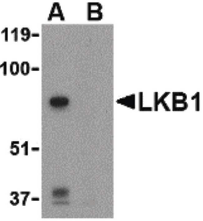 STK11 / LKB1 Antibody - Western blot of LKB1 in PC-3 cell lysate with LKB1 antibody at 1 ug/ml in the (A) absence or (B) presence of blocking peptide.