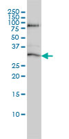 STK16 Antibody - STK16 monoclonal antibody, clone M2 Western blot of STK16 expression in A-431.