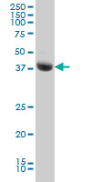 STK17B / DRAK2 Antibody - STK17B monoclonal antibody (M01), clone 2C3 Western blot of STK17B expression in Jurkat.