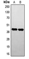 STK17B / DRAK2 Antibody - Western blot analysis of STK17B expression in Jurkat (A); A673 (B) whole cell lysates.