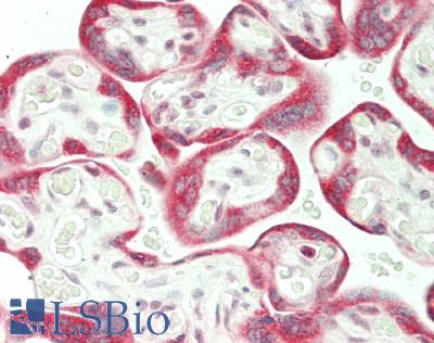 STK17B / DRAK2 Antibody - Human Placenta: Formalin-Fixed, Paraffin-Embedded (FFPE)