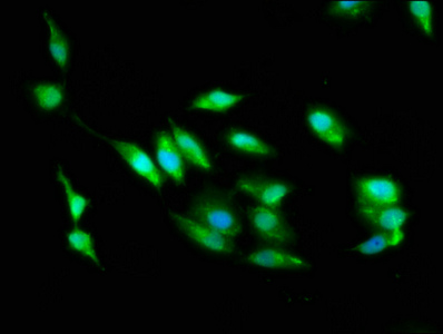 STK24 / MST3 Antibody - Immunofluorescence staining of Hela cells with STK24 Antibody at 1:100, counter-stained with DAPI. The cells were fixed in 4% formaldehyde, permeabilized using 0.2% Triton X-100 and blocked in 10% normal Goat Serum. The cells were then incubated with the antibody overnight at 4°C. The secondary antibody was Alexa Fluor 488-congugated AffiniPure Goat Anti-Rabbit IgG(H+L).