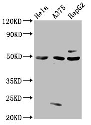 STK24 / MST3 Antibody - Western Blot Positive WB detected in: Hela whole cell lysate, A375 whole cell lysate, HepG2 whole cell lysate All lanes: STK24 antibody at 3µg/ml Secondary Goat polyclonal to rabbit IgG at 1/50000 dilution Predicted band size: 50, 48 kDa Observed band size: 50 kDa