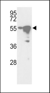 STK25 Antibody - Western blot of hYSK-H340 in Ramos and HepG2 cell line lysates (35 ug/lane). YSK (arrow) was detected using the purified antibody.