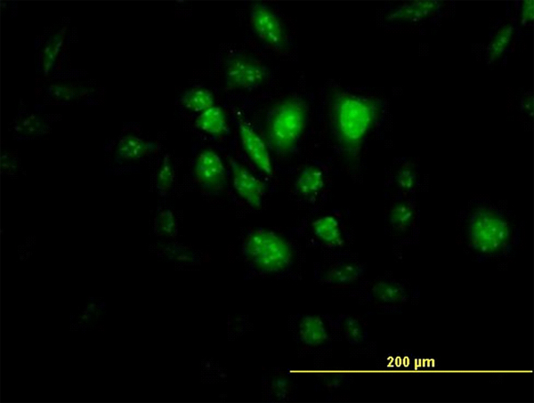 STK33 Antibody - Immunofluorescence of monoclonal antibody to STK33 on HeLa cell (antibody concentration 10 ug/ml).