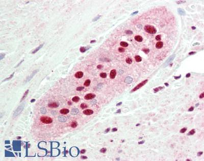STK36 Antibody - Human Colon, Myenteric Plexus: Formalin-Fixed, Paraffin-Embedded (FFPE)