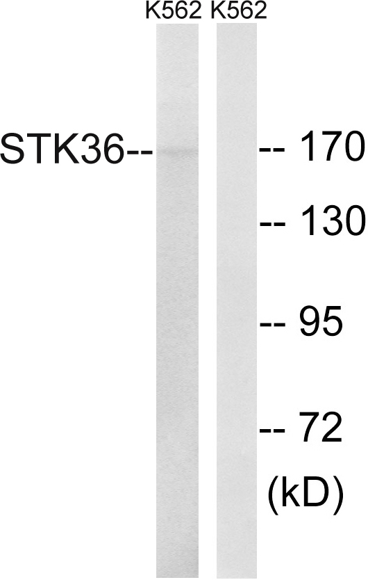 STK36 Antibody - Western blot analysis of lysates from K562 cells, using STK36 Antibody. The lane on the right is blocked with the synthesized peptide.