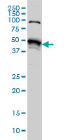 STK38 Antibody - Western blot of STK38 expression in HeLa NE.
