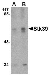 STK39 / SPAK Antibody - Western blot of Stk39 in SK-N-SH cell lysate with Stk39 antibody at (A) 1 and (B) 2 ug/ml.