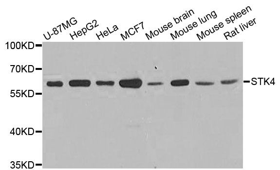 STK4 Antibody - Western blot blot of extracts of various cell lines, using STK4 antibody.