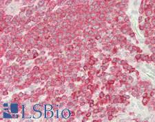 STK4 Antibody - Human Spleen: Formalin-Fixed, Paraffin-Embedded (FFPE)