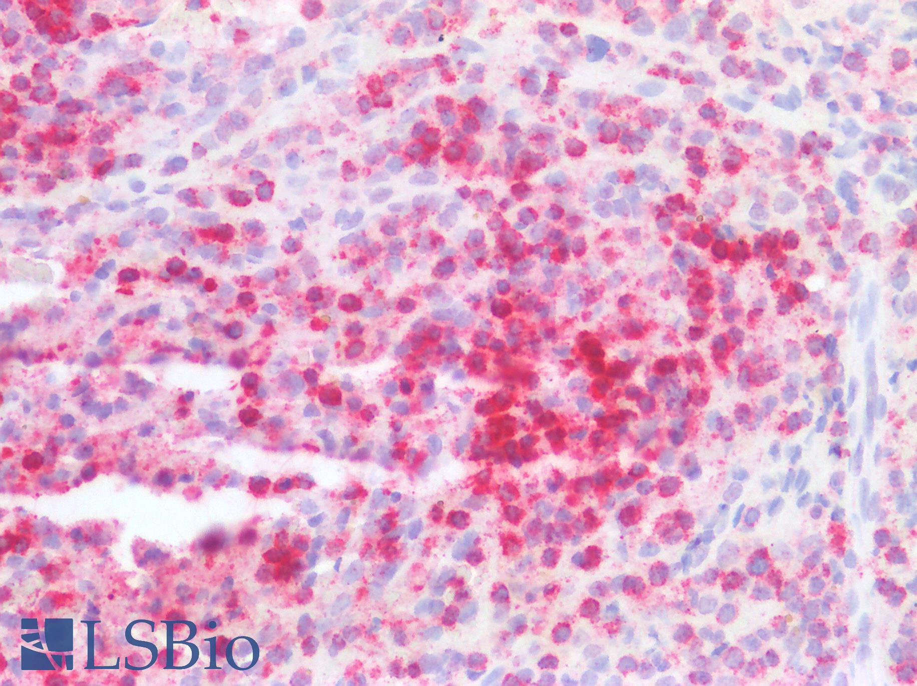 STK4 Antibody - Human Spleen: Formalin-Fixed, Paraffin-Embedded (FFPE)