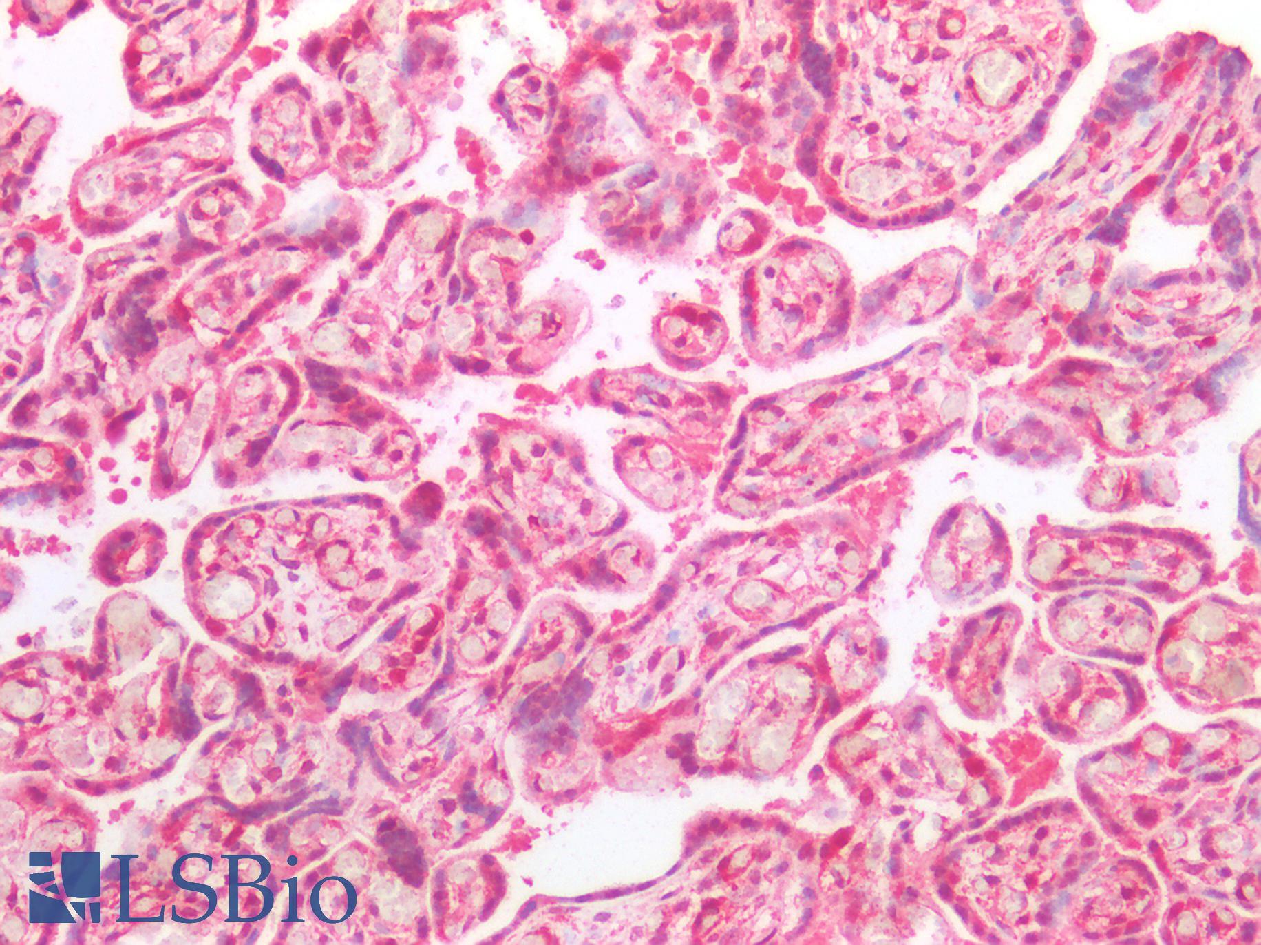 STMN1 / Stathmin / LAG Antibody - Human Placenta: Formalin-Fixed, Paraffin-Embedded (FFPE)