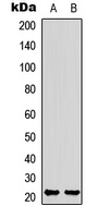 STMN4 / RB3 Antibody - Western blot analysis of RB3 expression in HEK293T (A); SK-N-SH (B) whole cell lysates.