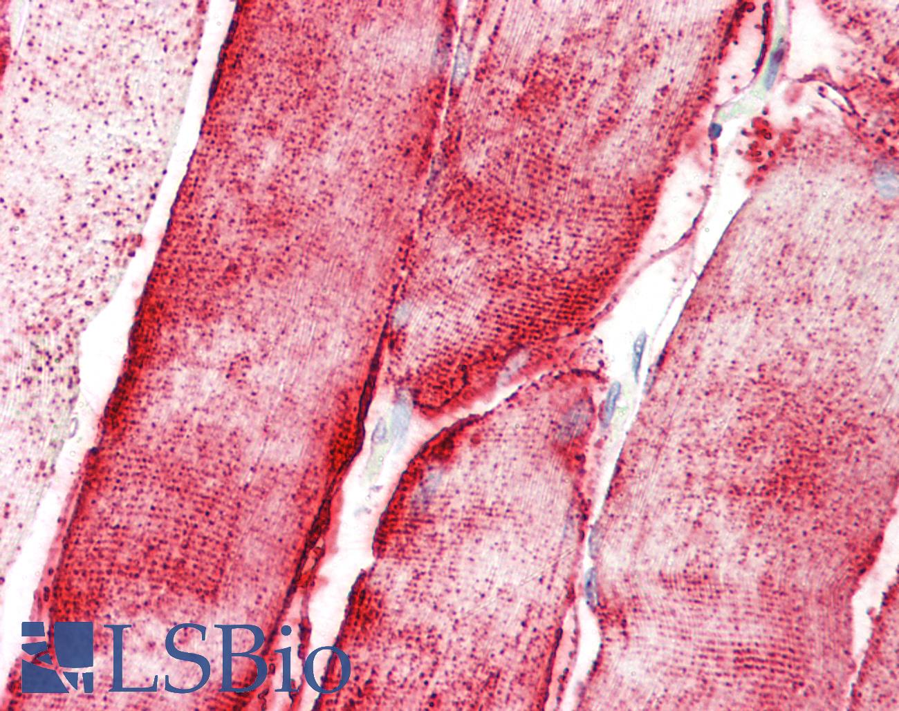 STOX1 Antibody - Anti-STOX1 antibody IHC staining of human skeletal muscle. Immunohistochemistry of formalin-fixed, paraffin-embedded tissue after heat-induced antigen retrieval.