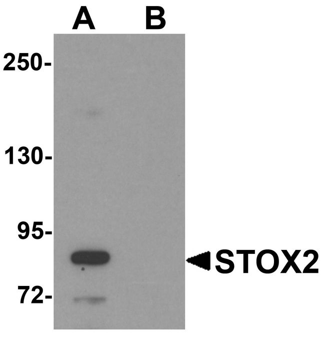 STOX2 Antibody - Western blot analysis of STOX2 in human kidney tissue lysate with STOX2 antibody at 1 ug/ml in (A) the absence and (B) the presence of blocking peptide.