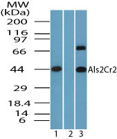 STRADB / ALS2CR2 Antibody - Western blot of Als2Cr2 in human brain lysate in the 1) absence and2) presence of immunizing peptide, and 3) mouse brain using STRADB / ALS2CR2 Antibody at 4.0 ug/ml and 2 ug/ml, respectively.
