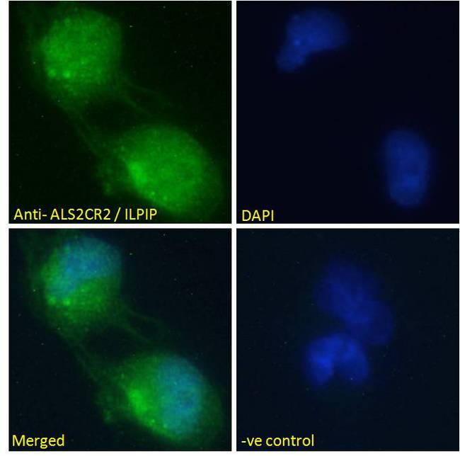 STRADB / ALS2CR2 Antibody - Goat Anti-ALS2CR2 / ILPIP Antibody Immunofluorescence analysis of paraformaldehyde fixed U251 cells, permeabilized with 0.15% Triton. Primary incubation 1hr (10ug/ml) followed by Alexa Fluor 488 secondary antibody (2ug/ml), showing nuclear and cytoplasmic staining. The nuclear stain is DAPI (blue). Negative control: Unimmunized goat IgG (10ug/ml) followed by Alexa Fluor 488 secondary antibody (2ug/ml).