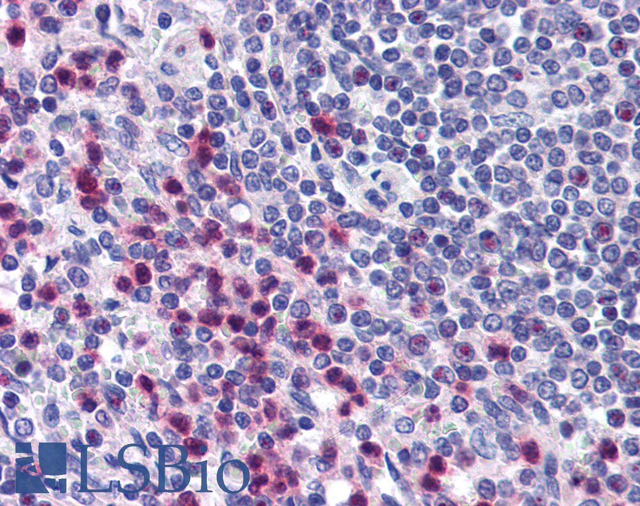 STRAP / MAWD Antibody - Anti-STRAP antibody IHC of human spleen. Immunohistochemistry of formalin-fixed, paraffin-embedded tissue after heat-induced antigen retrieval. Antibody concentration 10 ug/ml.