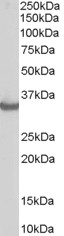 STUB1 / CHIP Antibody - Antibody staining (0.3 ug/ml) of Human Muscle lysate (RIPA buffer, 35 ug total protein per lane). Primary incubated for 1 hour. Detected by Western blot of chemiluminescence.