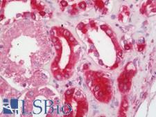 STUB1 / CHIP Antibody - Human Kidney: Formalin-Fixed, Paraffin-Embedded (FFPE)