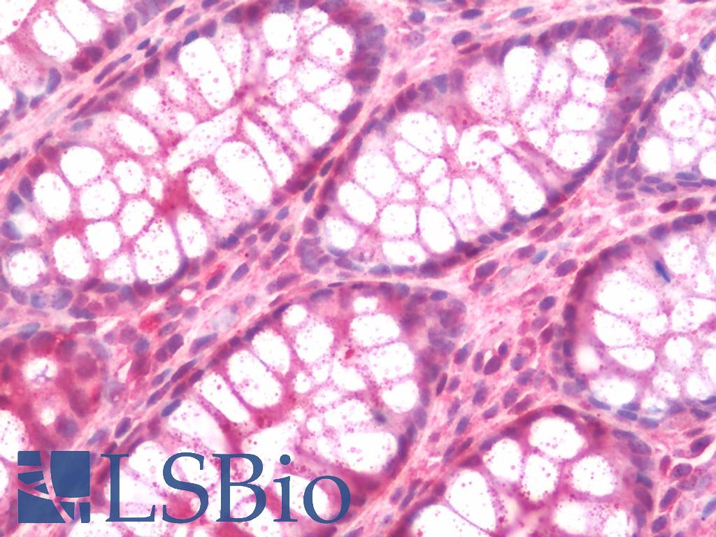 STUB1 / CHIP Antibody - Anti-STUB1 / CHIP antibody IHC staining of human colon. Immunohistochemistry of formalin-fixed, paraffin-embedded tissue after heat-induced antigen retrieval. Antibody concentration 7.5 ug/ml.