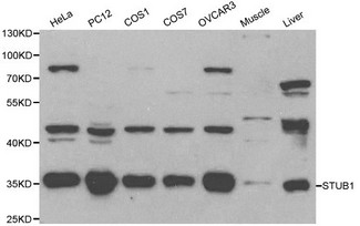 STUB1 / CHIP Antibody - Western blot of STUB1 pAb in extracts from Hela, PC12, COS1, COS7, OVCAR3 cells and mouse muscle,liver tissues.