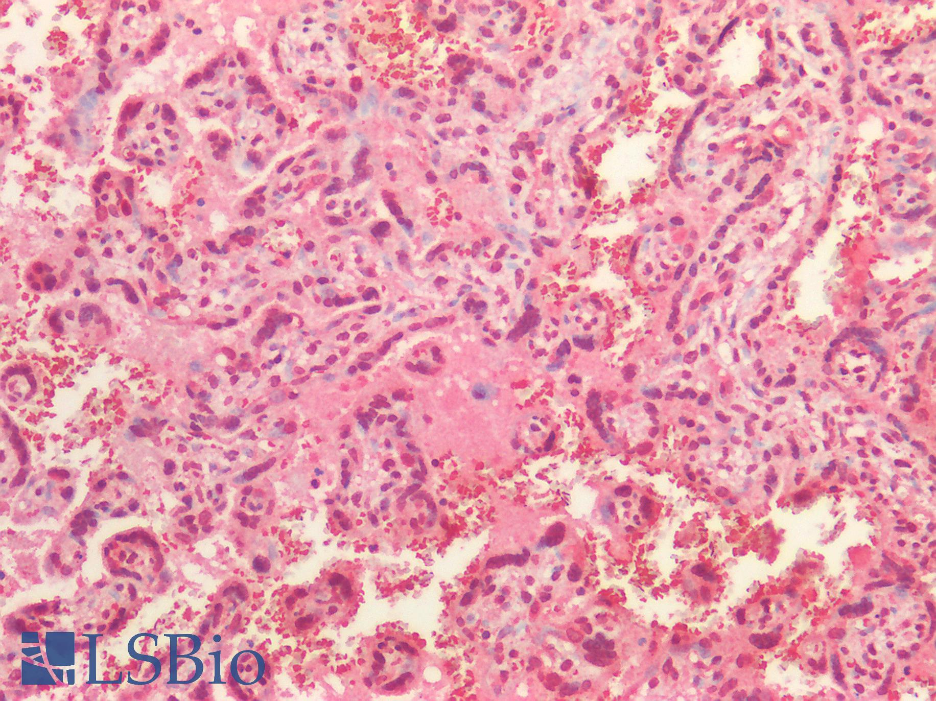 STUB1 / CHIP Antibody - Human Placenta: Formalin-Fixed, Paraffin-Embedded (FFPE)