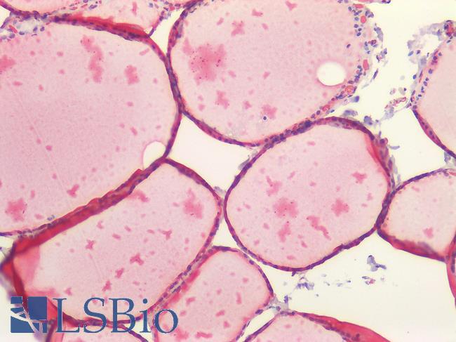 STUB1 / CHIP Antibody - Human Thyroid: Formalin-Fixed, Paraffin-Embedded (FFPE)