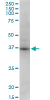 STX18 / Syntaxin 18 Antibody - Antibody Western blot of STX18 expression in PC-12.