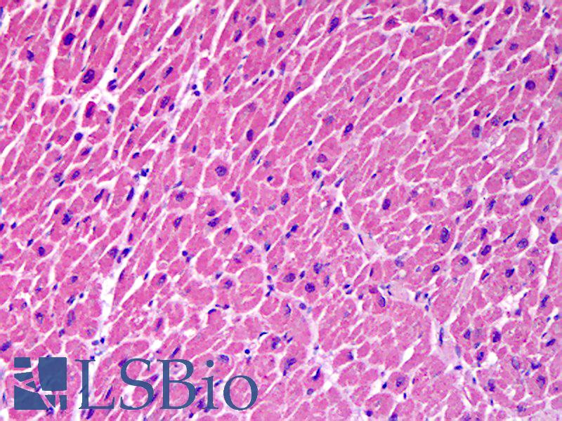 STX18 / Syntaxin 18 Antibody - Anti-STX18 / Syntaxin 18 antibody IHC of human heart. Immunohistochemistry of formalin-fixed, paraffin-embedded tissue after heat-induced antigen retrieval. Antibody concentration 5 ug/ml.